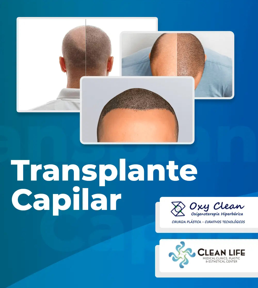 clean-life-transplante-capilar0001
